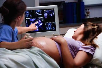 В Хабаровске женщинам, решившим сделать аборт, дадут послушать сердце своего ребенка